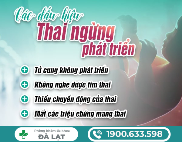 Hình ảnh minh họa